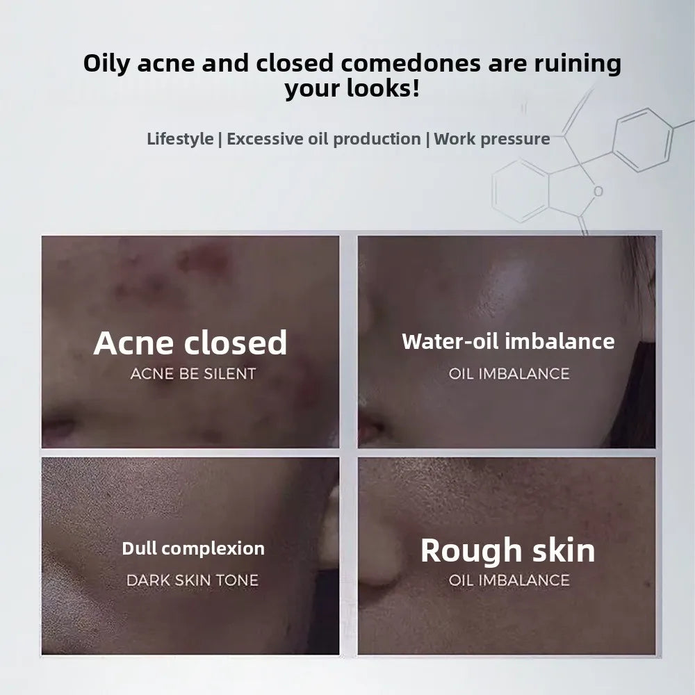 High-end Anti-aging Serum: Effectively Fades Wrinkles, Minimizes Rough Pores, Fast Absorption for 20-Year Youthful Glow